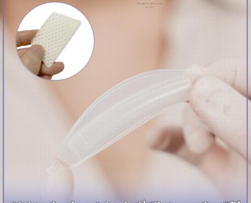 انتخاب اسپلینت بینی